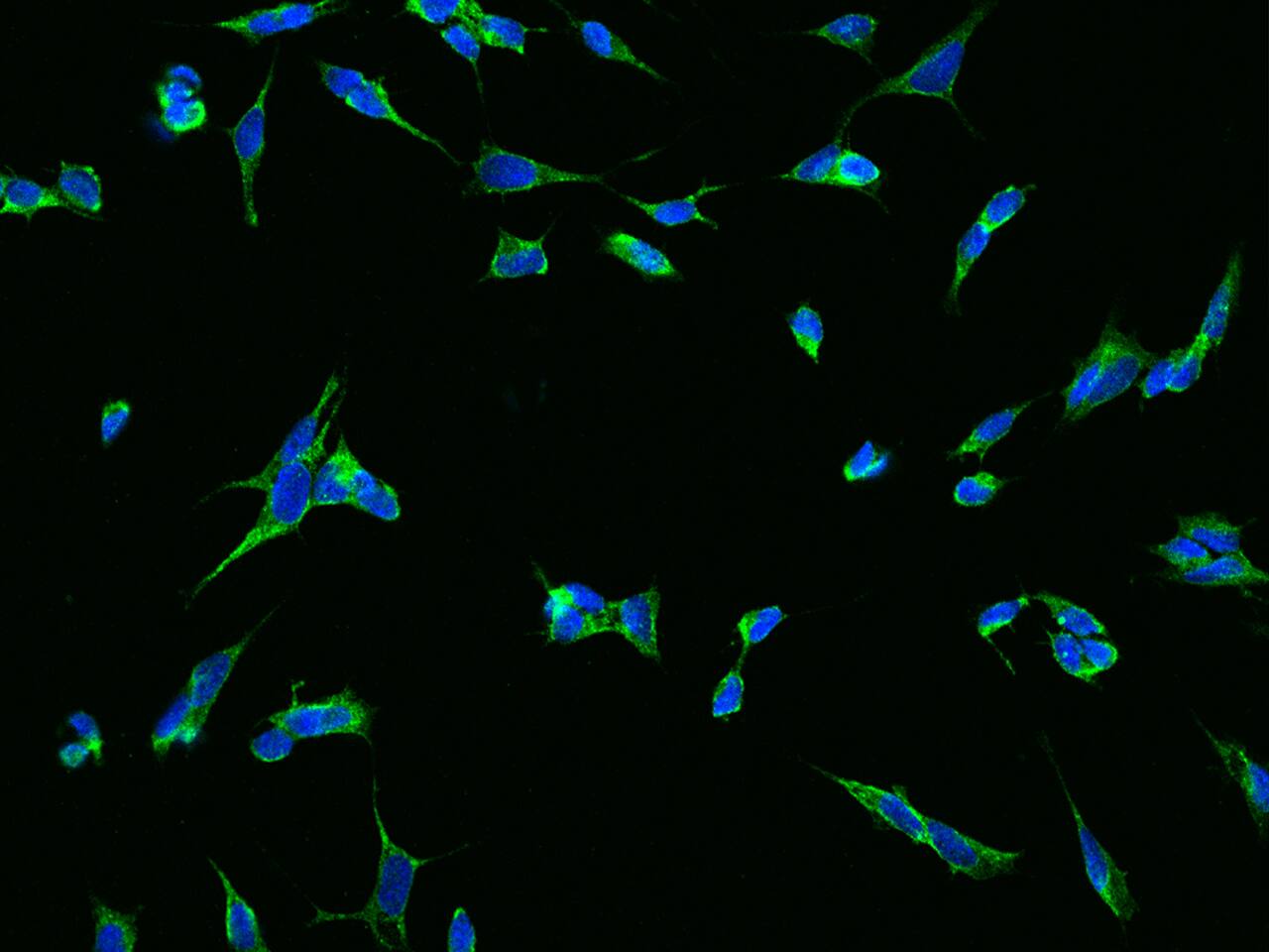 Immunocytochemistry/ Immunofluorescence: TMEM108 Antibody [NBP3-21447] - Immunofluorescence staining of TMEM108 in SHSYSY cells. Cells were fixed with 4% PFA, permeabilzed with 0.3% Triton X-100 in PBS, blocked with 10% serum, and incubated with NBP3-21447 (dilution ratio 1:200) at 4C overnight. Then cells were stained with the Alexa Fluor 488-conjugated Goat Anti-rabbit IgG secondary antibody (green) and counterstained with DAPI (blue). Positive staining was localized to Cytoplasm.