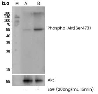 <b>Biological Strategies Validation. </b>Western Blot-NBP3-21480-AKT1 [p Ser473] Antibody (0113)-Analysis of extracts from serum-starved A431, untreated (-); treated with EGF (200 ng/mL, 15 min; +), using Phospho-AKT (Ser473) rabbit monoclonal Antibody at 1:2000 dilution (upper) or anti-Akt antibody (lower).