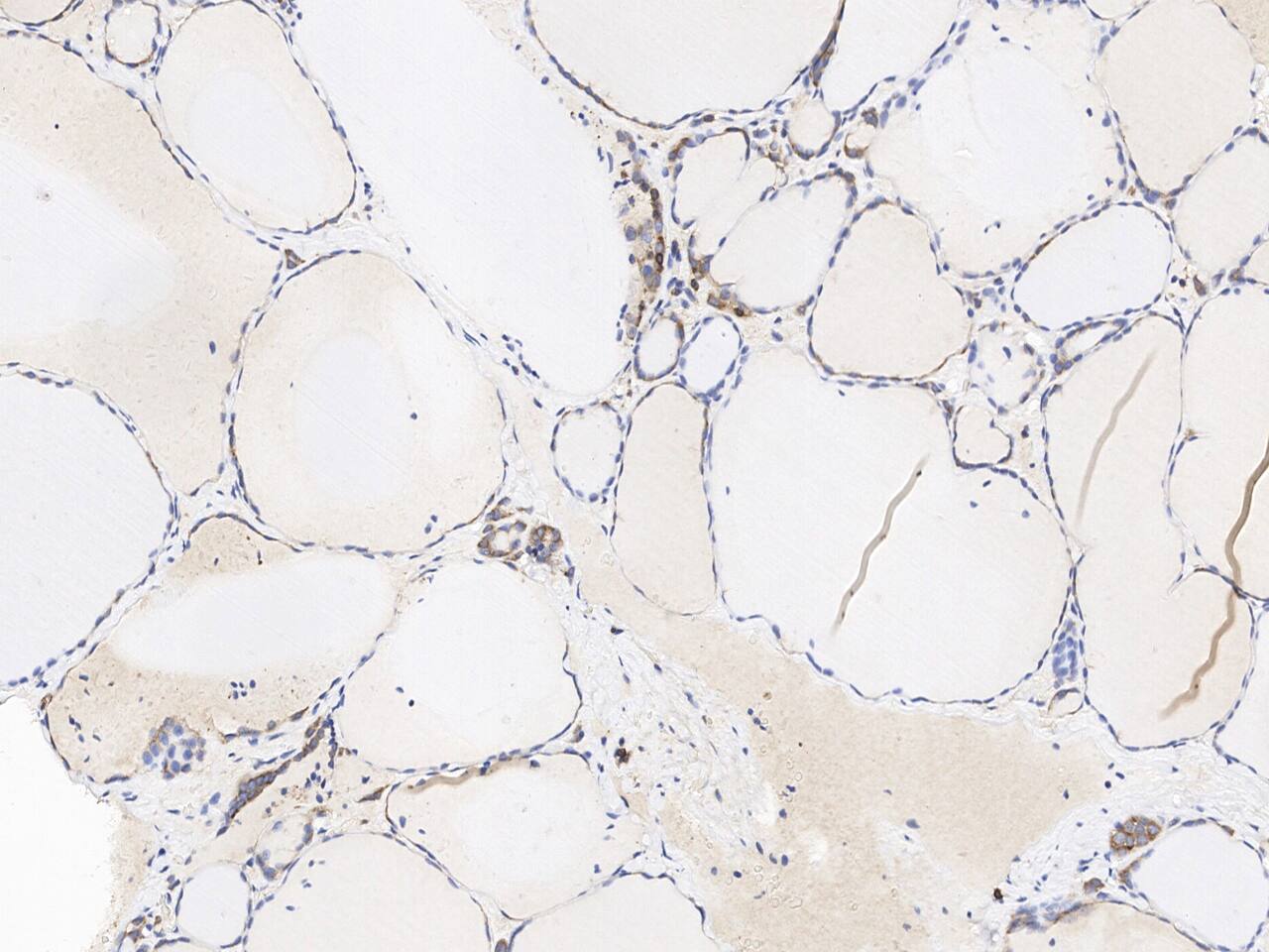 Immunohistochemistry-Paraffin: FAM119A Antibody [NBP3-21483] - Immunochemical staining of human FAM119A in human thyroid gland with NBP3-21483 at 1:100 dilution, formalin-fixed paraffin embedded sections.