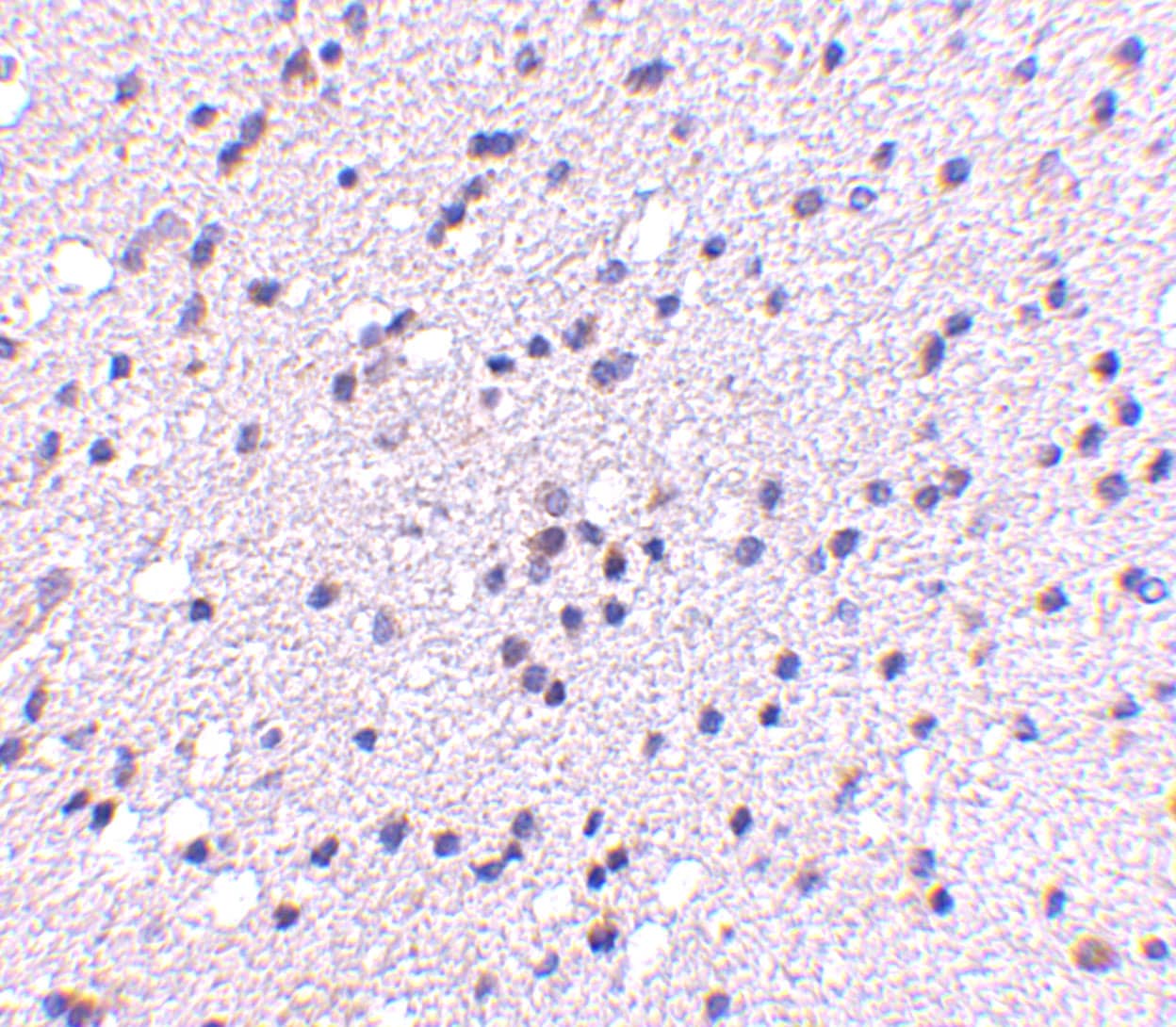 Immunohistochemistry CADPS2 Antibody - BSA Free