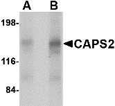 Western Blot CADPS2 Antibody - BSA Free