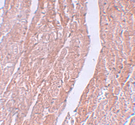 Immunohistochemistry: MINA Antibody - BSA Free [NBP3-21502] - Immunohistochemistry of MINA in mouse heart tissue with MINA antibody at 5 ug/mL.