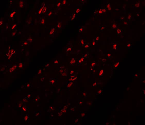 Immunocytochemistry/ Immunofluorescence: MINA Antibody - BSA Free [NBP3-21502] - Immunofluorescence of MINA in mouse heart tissue with MINA antibody at 20 ug/mL.