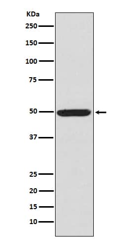 Western Blot: PKA R2 [p Ser 99] Antibody (SR1905) [NBP3-21511] - Western blot analysis using NBP3-21511 in K562 cell lysate.