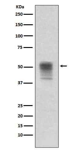 Western Blot: Tubulin alpha-1B [p Tyr 272] Antibody (SR1960) [NBP3-21518] - Western blot analysis on Jurkat cell lysates treated with pervanadate using NBP3-21518.
