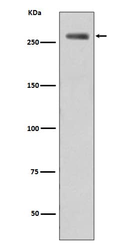 Western Blot: LRRK2 [p Ser 935] Antibody (SR1453) [NBP3-21519] - Western blot analysis using NBP3-21519 in WT-LRRK2 cell lysate treated LRRK2.