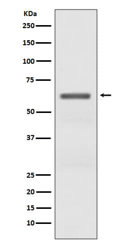 Western Blot: AMPK alpha 1/2 [p Thr 172] Antibody (SR2077) [NBP3-21537] - Western blot analysis using NBP3-21537 in Mouse heart lysate.