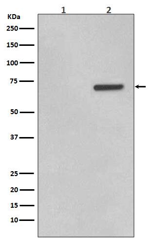 Western Blot: ATF2 [p Thr 71] Antibody (SR2159) [NBP3-21538] - Western blot analysis using NBP3-21538 in (1) HeLa cell lysate; (2) HeLa cell lysate treated with Anisomycin.