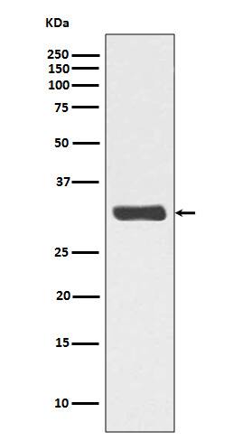 Western Blot: RPA2 [p Thr 21] Antibody (SR1535) [NBP3-21543] - Western blot analysis using NBP3-21543 in HeLa cell lysate treated with Calyculin A.