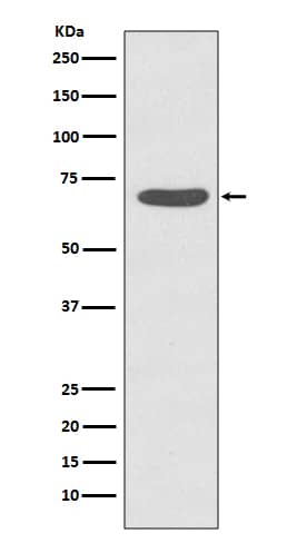 Western Blot: PKC zeta [p Thr 560] Antibody (SR2127) [NBP3-21553] - Western blot analysis using NBP3-21553 in HeLa cell treated with Calyculin A lysate.