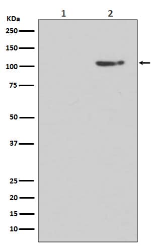 Western Blot: GluR1 [p Ser 845] Antibody (SR1027) [NBP3-21554] - Western blot analysis using NBP3-21554 in (1) Human brain lysate treated with Lambda phosphatase lysate; (2) Human brain lysate.