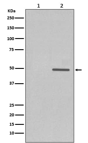 Western Blot: Cyclin E1 [p Thr 77] Antibody (SR1828) [NBP3-21555] - Western blot analysis using NBP3-21555 in (1) JAR cell treated with Lambda Phosphatase lysate; (2) JAR cell lysate.