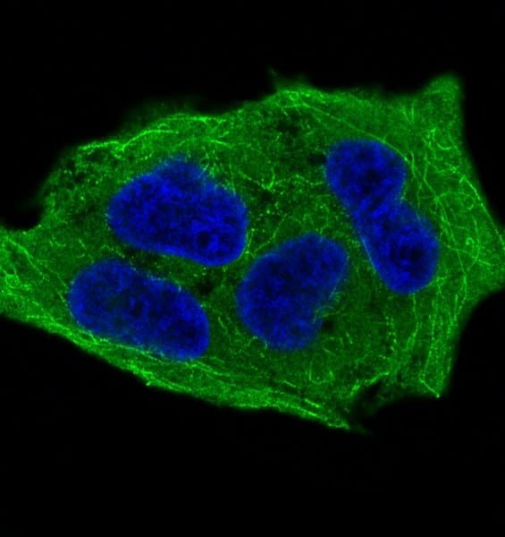 Immunocytochemistry/Immunofluorescence: GSK-3 beta [p Ser 9] Antibody (SR1801) [NBP3-21576] - Immunofluorescent analysis of HeLa cells treated with Calyculin A, using NBP3-21576.