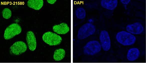 Immunocytochemistry/Immunofluorescence: Nrf2 [p Ser 40] Antibody (SR2277) [NBP3-21580] - Immunofluorescent analysis of HepG2 cells, using NBP3-21580.