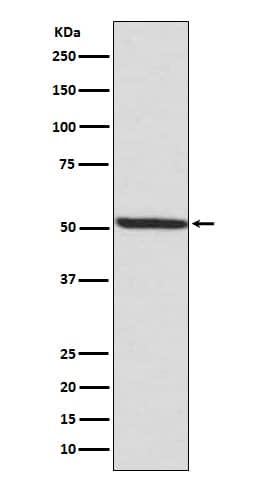 Western Blot: IRF3 [p Ser 386] Antibody (SR1819) [NBP3-21582] - Western blot analysis using NBP3-21582 in MCF7 cell lysate.