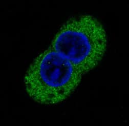 Immunocytochemistry/Immunofluorescence: Phospho-Tyrosine Antibody (SR2321) [NBP3-21585] - Immunofluorescent analysis of A431 cells treated with pervanadate, using NBP3-21585.