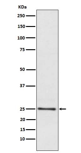 Western Blot: LYPLA1 Antibody (SR1383) [NBP3-21590] - Western blot analysis using NBP3-21590 in Human fetal liver lysate.