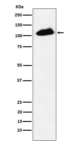 Western Blot: KAP1 [p Ser 824] Antibody (SR1057) [NBP3-21591] - Western blot analysis using NBP3-21591 in HeLa cell treated with etoposide.