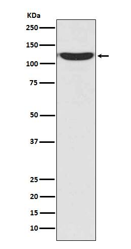 Western Blot: PKN2 Antibody (SR1067) [NBP3-21618] - Western blot analysis using NBP3-21618 in 293T cell lysate.