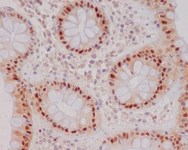 Immunohistochemistry: p21/CIP1/CDKN1A Antibody (SR1331) [NBP3-21623] - Immunohistochemical analysis of paraffin-embedded human colon, using NBP3-21623.