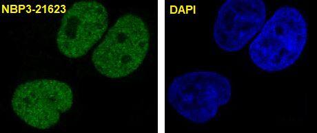 Immunocytochemistry/Immunofluorescence: p21/CIP1/CDKN1A Antibody (SR1331) [NBP3-21623] - Immunofluorescent analysis of MCF7 cells, using NBP3-21623.