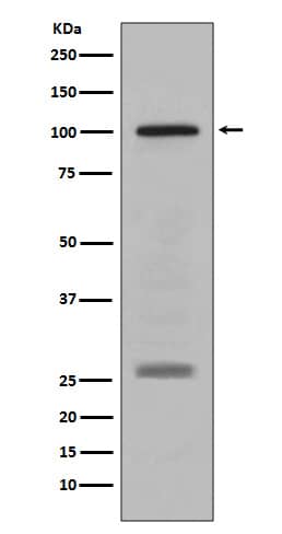 Western Blot: PMEL17/SILV Antibody (SR1021) [NBP3-21629] - Western blot analysis using NBP3-21629 in human melanoma lysate.