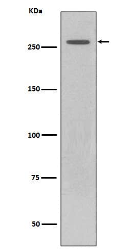 Western Blot: LRRK2 Antibody (SR1451) [NBP3-21641] - Western blot analysis using NBP3-21641 in GFP-LRRK2 lysate.