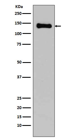 Western Blot: pan Cadherin Antibody (SR1156) [NBP3-21651] - Western blot analysis using NBP3-21651 in C6 cell lysate.