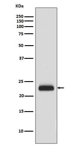 Western Blot: RAIDD/CRADD Antibody (SR1368) [NBP3-21652] - Western blot analysis using NBP3-21652 in HeLa cell lysate.