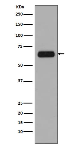 Western Blot: TCF7L1/TCF3 Antibody (SR2086) [NBP3-21655] - Western blot analysis using NBP3-21655 in A431 cell lysate.