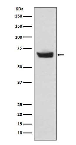 Western Blot: CETP Antibody (SR1985) [NBP3-21657] - Western blot analysis using NBP3-21657 in human plasma lysate.