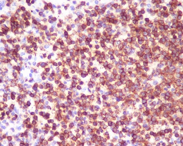 Immunohistochemistry: CD45 Antibody (SR1188) [NBP3-21659] - Immunohistochemical analysis of paraffin-embedded human spleen, using NBP3-21659.