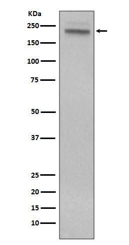 Western Blot: CD45 Antibody (SR1188) [NBP3-21659] - Western blot analysis using NBP3-21659 in Jurkat cell lysate.