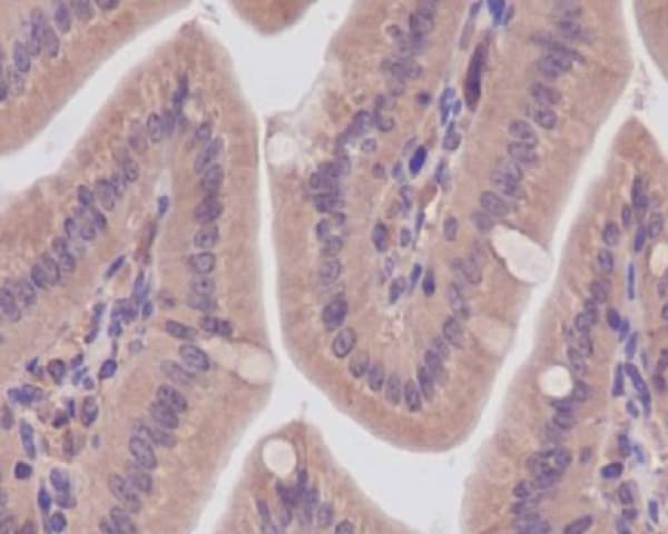 Immunohistochemistry: CaM Kinase II Antibody (SR1753) [NBP3-21661] - Immunohistochemical analysis of paraffin-embedded mouse colon, using NBP3-21661.