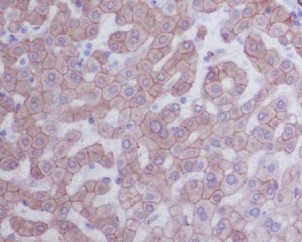 Immunohistochemistry: Cytokeratin 8 Antibody (SR1933) [NBP3-21664] - Immunohistochemical analysis of paraffin-embedded human liver, using NBP3-21664.