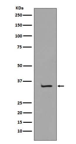 Western Blot: TATA binding protein TBP Antibody (SR1605) [NBP3-21665] - Western blot analysis using NBP3-21665 in K562 cell lysate.