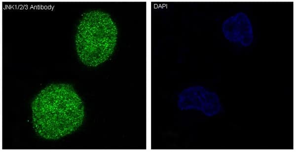 Immunocytochemistry/Immunofluorescence: JNK1/2/3 Antibody (SR1787) [NBP3-21671] - Immunofluorescent analysis of Hela cells, using NBP3-21671.