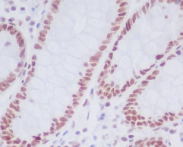 Immunohistochemistry: LSD1 Antibody (SR1059) [NBP3-21674] - Immunohistochemical analysis of paraffin-embedded human colon, using NBP3-21674.