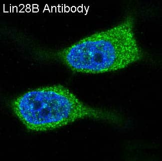 Immunocytochemistry/Immunofluorescence: LIN-28B Antibody (SR1509) [NBP3-21675] - Immunofluorescent analysis of MCF-7 cells, using NBP3-21675.