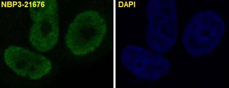 Immunocytochemistry/Immunofluorescence: p21/CIP1/CDKN1A Antibody (SR1330) [NBP3-21676] - Immunofluorescent analysis of MCF7 cells, using NBP3-21676.