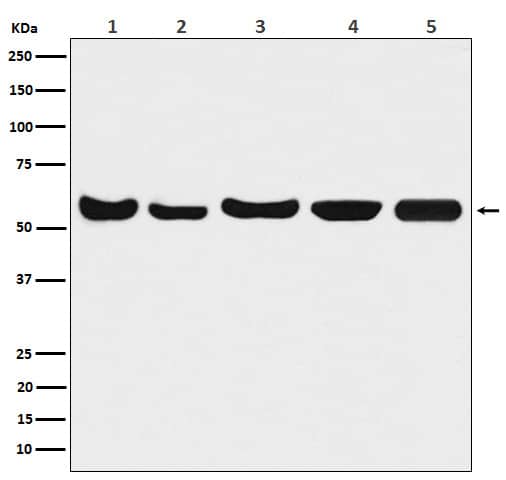 Western Blot: AKT1/2/3 Antibody (SR2006) [NBP3-21678] - Western blot analysis using NBP3-21678 in (1) A549 cell lysate; (2) Mouse brain lysate; (3) Rat brain lysate; (4) Rat heart lysate; (5) Rat kidney lysate.