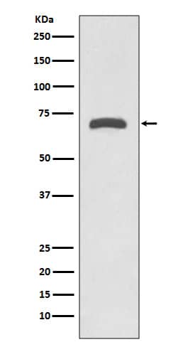 Western Blot: MMP-8 Antibody (SR1941) [NBP3-21683] - Western blot analysis using NBP3-21683 in Human placenta lysate.