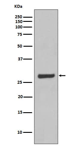 Western Blot: Aquaporin-5 Antibody (SR1459) [NBP3-21684] - Western blot analysis using NBP3-21684 in SW480 cell lysate.