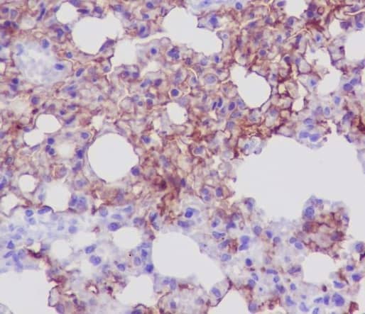 Immunohistochemistry: Aquaporin-5 Antibody (SR1459) [NBP3-21684] - Immunohistochemical analysis of paraffin-embedded mouse lung, using NBP3-21684.