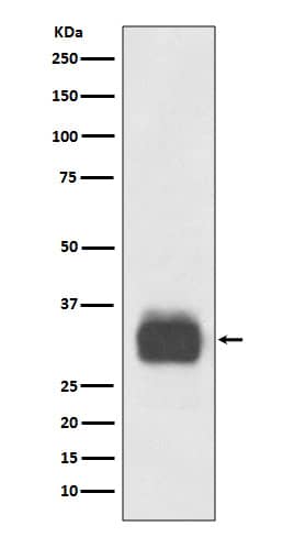 Western Blot: Tryptase alpha/beta 1 Antibody (SR1510) [NBP3-21686] - Western blot analysis using NBP3-21686 in Human tonsil lysate.