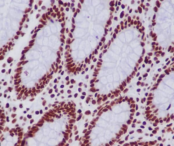 Immunohistochemistry: Histone H2B type 1B Antibody (SR1212) [NBP3-21687] - Immunohistochemical analysis of paraffin-embedded human colon, using NBP3-21687.
