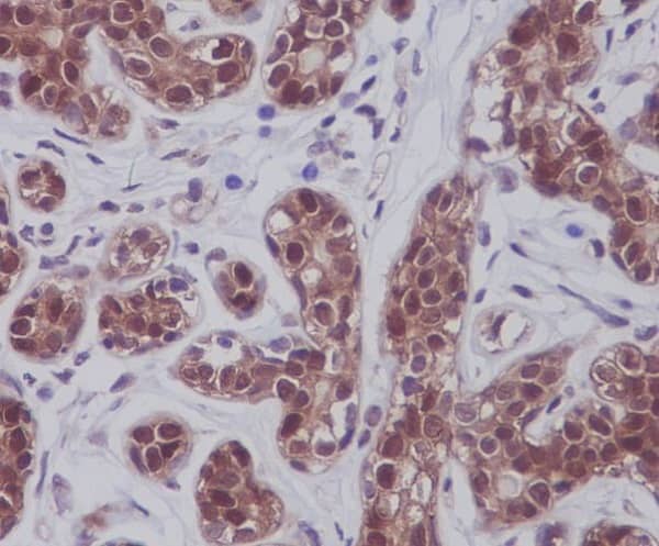 Immunohistochemistry: STAT5a/b Antibody (SR2282) [NBP3-21692] - Immunohistochemical analysis of paraffin-embedded human breast, using NBP3-21692.