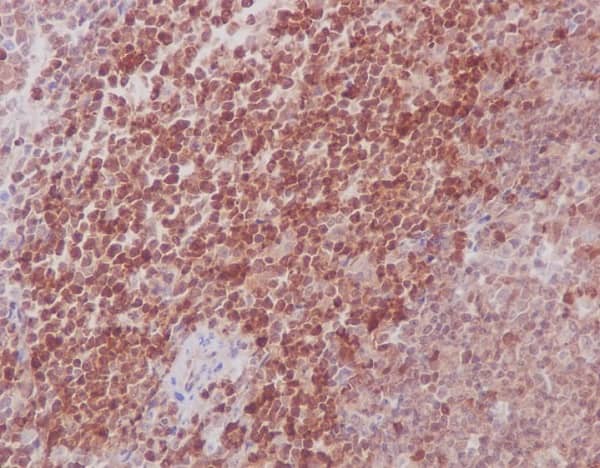 Immunohistochemistry: MKK3/MKK6 Antibody (SR1645) [NBP3-21693] - Immunohistochemical analysis of paraffin-embedded mouse spleen, using NBP3-21693.