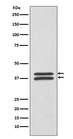 Western Blot: MKK3/MKK6 Antibody (SR1645) [NBP3-21693] - Western blot analysis using NBP3-21693 in HeLa cell lysate.