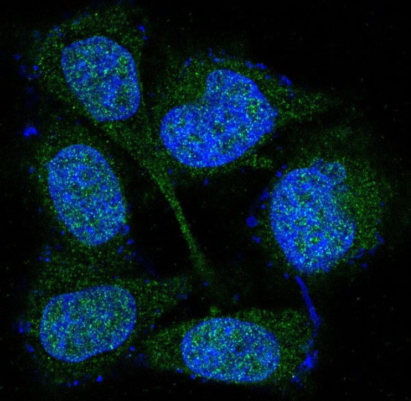 Immunocytochemistry/Immunofluorescence: MKK3/MKK6 Antibody (SR1645) [NBP3-21693] - Immunofluorescent analysis of Hela cells, using NBP3-21693.